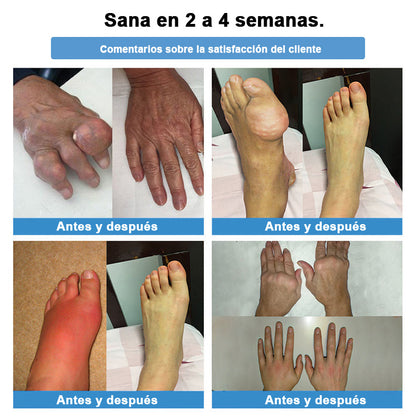 𝐓𝐢𝐞𝐧𝐝𝐚 𝐨𝐟𝐢𝐜𝐢𝐚𝐥: 👩‍⚕️ 𝐇𝐞𝐚𝐥𝐫𝐢𝐳𝐞® 𝐓𝐞𝐫𝐚𝐩𝐢𝐚 𝐧𝐚𝐧𝐨-𝐩𝐞𝐧𝐞𝐭𝐫𝐚𝐧𝐭𝐞 𝐩𝐚𝐫𝐚 𝐚𝐫𝐭𝐢𝐜𝐮𝐥𝐚𝐜𝐢𝐨𝐧𝐞𝐬 (𝐢𝐧𝐝𝐨𝐥𝐨𝐫𝐚, 𝐝𝐞 𝐞𝐟𝐞𝐜𝐭𝐨 𝐝𝐮𝐫𝐚𝐝𝐞𝐫𝐨, 𝐚𝐝𝐞𝐜𝐮𝐚𝐝𝐚 𝐩𝐚𝐫𝐚 𝐚𝐫𝐭𝐫𝐢𝐭𝐢𝐬, 𝐯𝐚𝐫𝐢𝐜𝐞𝐬 𝐲 𝐝𝐢𝐯𝐞𝐫𝐬𝐚𝐬 𝐚𝐟𝐞𝐜𝐜𝐢𝐨𝐧𝐞𝐬 𝐨𝐫𝐭𝐨𝐩é𝐝𝐢𝐜𝐚𝐬) 🥑🥑