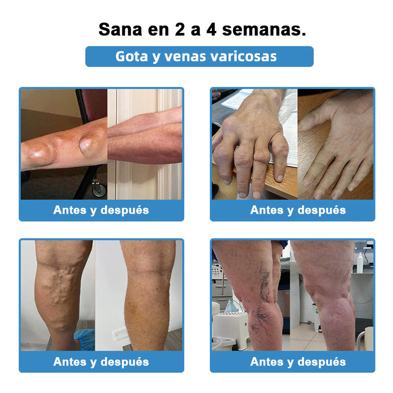 𝐓𝐢𝐞𝐧𝐝𝐚 𝐨𝐟𝐢𝐜𝐢𝐚𝐥: 👩‍⚕️ 𝐇𝐞𝐚𝐥𝐫𝐢𝐳𝐞® 𝐓𝐞𝐫𝐚𝐩𝐢𝐚 𝐧𝐚𝐧𝐨-𝐩𝐞𝐧𝐞𝐭𝐫𝐚𝐧𝐭𝐞 𝐩𝐚𝐫𝐚 𝐚𝐫𝐭𝐢𝐜𝐮𝐥𝐚𝐜𝐢𝐨𝐧𝐞𝐬 (𝐢𝐧𝐝𝐨𝐥𝐨𝐫𝐚, 𝐝𝐞 𝐞𝐟𝐞𝐜𝐭𝐨 𝐝𝐮𝐫𝐚𝐝𝐞𝐫𝐨, 𝐚𝐝𝐞𝐜𝐮𝐚𝐝𝐚 𝐩𝐚𝐫𝐚 𝐚𝐫𝐭𝐫𝐢𝐭𝐢𝐬, 𝐯𝐚𝐫𝐢𝐜𝐞𝐬 𝐲 𝐝𝐢𝐯𝐞𝐫𝐬𝐚𝐬 𝐚𝐟𝐞𝐜𝐜𝐢𝐨𝐧𝐞𝐬 𝐨𝐫𝐭𝐨𝐩é𝐝𝐢𝐜𝐚𝐬) 🥑🥑