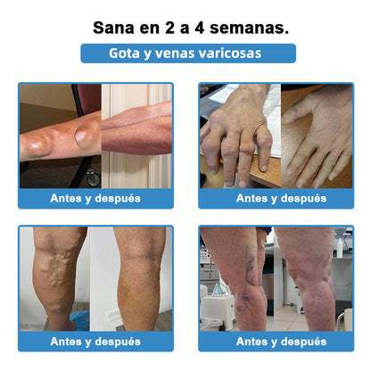 𝐓𝐢𝐞𝐧𝐝𝐚 𝐨𝐟𝐢𝐜𝐢𝐚𝐥: 👩‍⚕️ 𝐇𝐞𝐚𝐥𝐫𝐢𝐳𝐞® 𝐓𝐞𝐫𝐚𝐩𝐢𝐚 𝐧𝐚𝐧𝐨-𝐩𝐞𝐧𝐞𝐭𝐫𝐚𝐧𝐭𝐞 𝐩𝐚𝐫𝐚 𝐚𝐫𝐭𝐢𝐜𝐮𝐥𝐚𝐜𝐢𝐨𝐧𝐞𝐬 (𝐢𝐧𝐝𝐨𝐥𝐨𝐫𝐚, 𝐝𝐞 𝐞𝐟𝐞𝐜𝐭𝐨 𝐝𝐮𝐫𝐚𝐝𝐞𝐫𝐨, 𝐚𝐝𝐞𝐜𝐮𝐚𝐝𝐚 𝐩𝐚𝐫𝐚 𝐚𝐫𝐭𝐫𝐢𝐭𝐢𝐬, 𝐯𝐚𝐫𝐢𝐜𝐞𝐬 𝐲 𝐝𝐢𝐯𝐞𝐫𝐬𝐚𝐬 𝐚𝐟𝐞𝐜𝐜𝐢𝐨𝐧𝐞𝐬 𝐨𝐫𝐭𝐨𝐩é𝐝𝐢𝐜𝐚𝐬) 🥑🥑