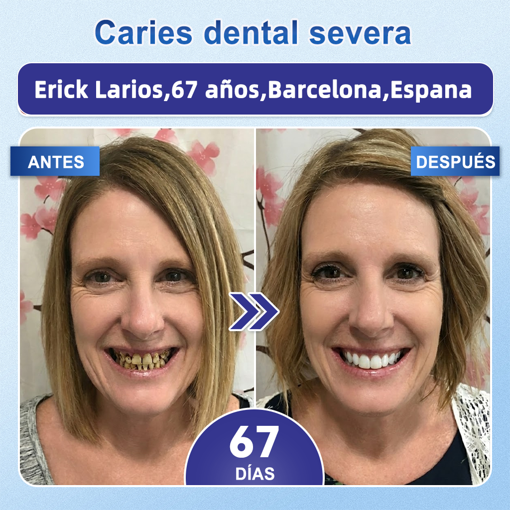 𝐆𝐚𝐫𝐚𝐠𝐞𝐋𝐢𝐧𝐞® 🥇 𝐓𝐢𝐫𝐚𝐬 𝐨𝐫𝐚𝐥𝐞𝐬 𝐝𝐞 𝐝𝐢𝐬𝐨𝐥𝐮𝐜𝐢ó𝐧 𝐫á𝐩𝐢𝐝𝐚 𝐓𝐢𝐝𝐞𝐠𝐥𝐮𝐬𝐢𝐛 𝐩𝐚𝐫𝐚 𝐥𝐚 𝐫𝐞𝐩𝐚𝐫𝐚𝐜𝐢ó𝐧 𝐝𝐞 𝐝𝐢𝐞𝐧𝐭𝐞𝐬 𝐲 𝐞𝐧𝐜í𝐚𝐬 🌱 (𝐀𝐩𝐨𝐲𝐚 𝐥𝐚 𝐫𝐞𝐩𝐚𝐫𝐚𝐜𝐢ó𝐧 𝐝𝐞𝐧𝐭𝐚𝐥 𝐲 𝐚𝐲𝐮𝐝𝐚 𝐚 𝐚𝐥𝐢𝐯𝐢𝐚𝐫 𝐥𝐚 𝐦𝐨𝐥𝐞𝐬𝐭𝐢𝐚 𝐝𝐞 𝐥𝐚𝐬 𝐞𝐧𝐜í𝐚𝐬 𝐲 𝐨𝐭𝐫𝐨𝐬 𝐩𝐫𝐨𝐛𝐥𝐞𝐦𝐚𝐬 𝐨𝐫𝐚𝐥𝐞𝐬 𝐜𝐨𝐦𝐮𝐧𝐞𝐬)