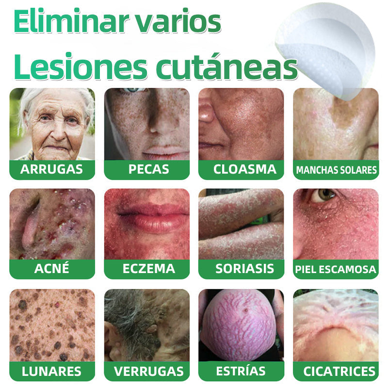 𝐇𝐮𝐝𝐫𝐨𝐬® 📌𝐏𝐚𝐫𝐜𝐡𝐞𝐬 𝐡𝐢𝐝𝐫𝐨𝐜𝐨𝐥𝐨𝐢𝐝𝐞𝐬 𝐜𝐨𝐧 𝐦𝐢𝐜𝐫𝐨𝐚𝐠𝐮𝐣𝐚𝐬 𝟐 𝐞𝐧 𝟏🛒 𝐄𝐬𝐩𝐞𝐜𝐢𝐚𝐥𝐦𝐞𝐧𝐭𝐞 𝐝𝐢𝐬𝐞ñ𝐚𝐝𝐨𝐬 𝐩𝐚𝐫𝐚 𝐞𝐥𝐢𝐦𝐢𝐧𝐚𝐫 𝐥𝐮𝐧𝐚𝐫𝐞𝐬 𝐞𝐥𝐞𝐯𝐚𝐝𝐨𝐬, 𝐚𝐜𝐧é, 𝐯𝐞𝐫𝐫𝐮𝐠𝐚𝐬 𝐩𝐥𝐚𝐧𝐚𝐬 𝐲 𝐩𝐫𝐨𝐭𝐮𝐛𝐞𝐫𝐚𝐧𝐜𝐢𝐚𝐬 𝐜𝐮𝐭á𝐧𝐞𝐚𝐬 | 𝐏𝐚𝐪𝐮𝐞𝐭𝐞 𝐝𝐞 𝟏𝟒𝟒 𝐮𝐧𝐢𝐝𝐚𝐝𝐞𝐬🌳🌳