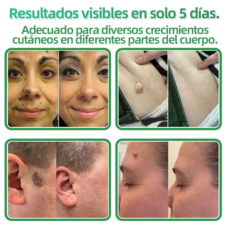 𝐇𝐮𝐝𝐫𝐨𝐬® 📌𝐏𝐚𝐫𝐜𝐡𝐞𝐬 𝐡𝐢𝐝𝐫𝐨𝐜𝐨𝐥𝐨𝐢𝐝𝐞𝐬 𝐜𝐨𝐧 𝐦𝐢𝐜𝐫𝐨𝐚𝐠𝐮𝐣𝐚𝐬 𝟐 𝐞𝐧 𝟏🛒 𝐄𝐬𝐩𝐞𝐜𝐢𝐚𝐥𝐦𝐞𝐧𝐭𝐞 𝐝𝐢𝐬𝐞ñ𝐚𝐝𝐨𝐬 𝐩𝐚𝐫𝐚 𝐞𝐥𝐢𝐦𝐢𝐧𝐚𝐫 𝐥𝐮𝐧𝐚𝐫𝐞𝐬 𝐞𝐥𝐞𝐯𝐚𝐝𝐨𝐬, 𝐚𝐜𝐧é, 𝐯𝐞𝐫𝐫𝐮𝐠𝐚𝐬 𝐩𝐥𝐚𝐧𝐚𝐬 𝐲 𝐩𝐫𝐨𝐭𝐮𝐛𝐞𝐫𝐚𝐧𝐜𝐢𝐚𝐬 𝐜𝐮𝐭á𝐧𝐞𝐚𝐬 | 𝐏𝐚𝐪𝐮𝐞𝐭𝐞 𝐝𝐞 𝟏𝟒𝟒 𝐮𝐧𝐢𝐝𝐚𝐝𝐞𝐬🌳🌳