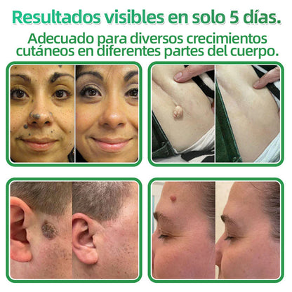 𝐇𝐮𝐝𝐫𝐨𝐬® 📌𝐏𝐚𝐫𝐜𝐡𝐞𝐬 𝐡𝐢𝐝𝐫𝐨𝐜𝐨𝐥𝐨𝐢𝐝𝐞𝐬 𝐜𝐨𝐧 𝐦𝐢𝐜𝐫𝐨𝐚𝐠𝐮𝐣𝐚𝐬 𝟐 𝐞𝐧 𝟏🛒 𝐄𝐬𝐩𝐞𝐜𝐢𝐚𝐥𝐦𝐞𝐧𝐭𝐞 𝐝𝐢𝐬𝐞ñ𝐚𝐝𝐨𝐬 𝐩𝐚𝐫𝐚 𝐞𝐥𝐢𝐦𝐢𝐧𝐚𝐫 𝐥𝐮𝐧𝐚𝐫𝐞𝐬 𝐞𝐥𝐞𝐯𝐚𝐝𝐨𝐬, 𝐚𝐜𝐧é, 𝐯𝐞𝐫𝐫𝐮𝐠𝐚𝐬 𝐩𝐥𝐚𝐧𝐚𝐬 𝐲 𝐩𝐫𝐨𝐭𝐮𝐛𝐞𝐫𝐚𝐧𝐜𝐢𝐚𝐬 𝐜𝐮𝐭á𝐧𝐞𝐚𝐬 | 𝐏𝐚𝐪𝐮𝐞𝐭𝐞 𝐝𝐞 𝟏𝟒𝟒 𝐮𝐧𝐢𝐝𝐚𝐝𝐞𝐬🌳🌳