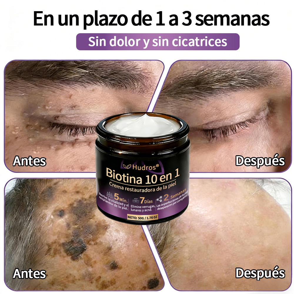 𝐅𝐚𝐛𝐫𝐢𝐜𝐚𝐝𝐨 𝐲 𝐞𝐧𝐯𝐢𝐚𝐝𝐨 𝐝𝐞𝐬𝐝𝐞 𝐄𝐬𝐩𝐚ñ𝐚 ✨𝐇𝐮𝐝𝐫𝐨𝐬® 𝐁𝐢𝐨𝐭𝐢𝐧 𝟏𝟎-𝐞𝐧-𝟏 𝐂𝐫𝐞𝐦𝐚 𝐫𝐞𝐬𝐭𝐚𝐮𝐫𝐚𝐝𝐨𝐫𝐚 𝐝𝐞 𝐥𝐚 𝐩𝐢𝐞𝐥 ☘️☘️
