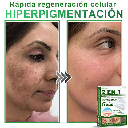 𝐇𝐮𝐝𝐫𝐨𝐬® 📌𝐏𝐚𝐫𝐜𝐡𝐞𝐬 𝐡𝐢𝐝𝐫𝐨𝐜𝐨𝐥𝐨𝐢𝐝𝐞𝐬 𝐜𝐨𝐧 𝐦𝐢𝐜𝐫𝐨𝐚𝐠𝐮𝐣𝐚𝐬 𝟐 𝐞𝐧 𝟏🛒 𝐄𝐬𝐩𝐞𝐜𝐢𝐚𝐥𝐦𝐞𝐧𝐭𝐞 𝐝𝐢𝐬𝐞ñ𝐚𝐝𝐨𝐬 𝐩𝐚𝐫𝐚 𝐞𝐥𝐢𝐦𝐢𝐧𝐚𝐫 𝐥𝐮𝐧𝐚𝐫𝐞𝐬 𝐞𝐥𝐞𝐯𝐚𝐝𝐨𝐬, 𝐚𝐜𝐧é, 𝐯𝐞𝐫𝐫𝐮𝐠𝐚𝐬 𝐩𝐥𝐚𝐧𝐚𝐬 𝐲 𝐩𝐫𝐨𝐭𝐮𝐛𝐞𝐫𝐚𝐧𝐜𝐢𝐚𝐬 𝐜𝐮𝐭á𝐧𝐞𝐚𝐬 | 𝐏𝐚𝐪𝐮𝐞𝐭𝐞 𝐝𝐞 𝟏𝟒𝟒 𝐮𝐧𝐢𝐝𝐚𝐝𝐞𝐬🌳🌳