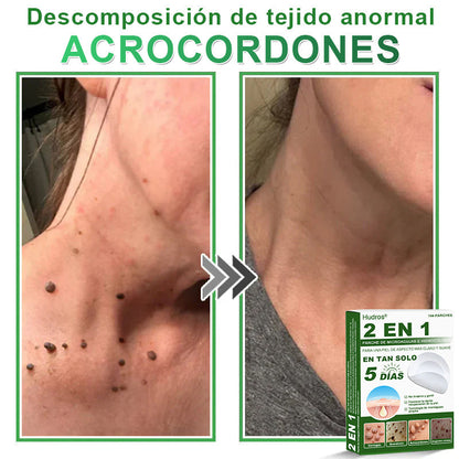 𝐇𝐮𝐝𝐫𝐨𝐬® 📌𝐏𝐚𝐫𝐜𝐡𝐞𝐬 𝐡𝐢𝐝𝐫𝐨𝐜𝐨𝐥𝐨𝐢𝐝𝐞𝐬 𝐜𝐨𝐧 𝐦𝐢𝐜𝐫𝐨𝐚𝐠𝐮𝐣𝐚𝐬 𝟐 𝐞𝐧 𝟏🛒 𝐄𝐬𝐩𝐞𝐜𝐢𝐚𝐥𝐦𝐞𝐧𝐭𝐞 𝐝𝐢𝐬𝐞ñ𝐚𝐝𝐨𝐬 𝐩𝐚𝐫𝐚 𝐞𝐥𝐢𝐦𝐢𝐧𝐚𝐫 𝐥𝐮𝐧𝐚𝐫𝐞𝐬 𝐞𝐥𝐞𝐯𝐚𝐝𝐨𝐬, 𝐚𝐜𝐧é, 𝐯𝐞𝐫𝐫𝐮𝐠𝐚𝐬 𝐩𝐥𝐚𝐧𝐚𝐬 𝐲 𝐩𝐫𝐨𝐭𝐮𝐛𝐞𝐫𝐚𝐧𝐜𝐢𝐚𝐬 𝐜𝐮𝐭á𝐧𝐞𝐚𝐬 | 𝐏𝐚𝐪𝐮𝐞𝐭𝐞 𝐝𝐞 𝟏𝟒𝟒 𝐮𝐧𝐢𝐝𝐚𝐝𝐞𝐬🌳🌳