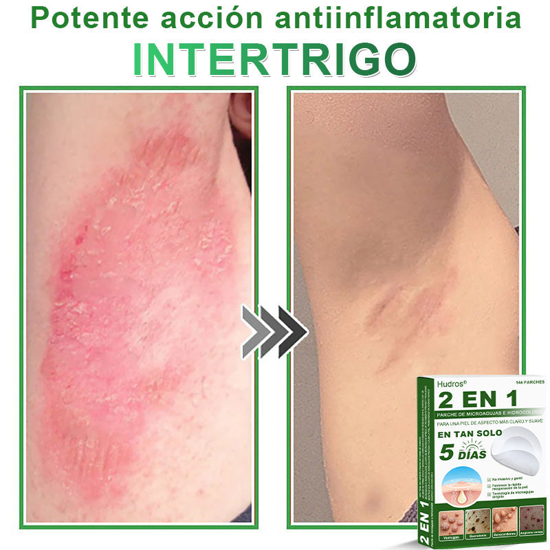𝐇𝐮𝐝𝐫𝐨𝐬® 📌𝐏𝐚𝐫𝐜𝐡𝐞𝐬 𝐡𝐢𝐝𝐫𝐨𝐜𝐨𝐥𝐨𝐢𝐝𝐞𝐬 𝐜𝐨𝐧 𝐦𝐢𝐜𝐫𝐨𝐚𝐠𝐮𝐣𝐚𝐬 𝟐 𝐞𝐧 𝟏🛒 𝐄𝐬𝐩𝐞𝐜𝐢𝐚𝐥𝐦𝐞𝐧𝐭𝐞 𝐝𝐢𝐬𝐞ñ𝐚𝐝𝐨𝐬 𝐩𝐚𝐫𝐚 𝐞𝐥𝐢𝐦𝐢𝐧𝐚𝐫 𝐥𝐮𝐧𝐚𝐫𝐞𝐬 𝐞𝐥𝐞𝐯𝐚𝐝𝐨𝐬, 𝐚𝐜𝐧é, 𝐯𝐞𝐫𝐫𝐮𝐠𝐚𝐬 𝐩𝐥𝐚𝐧𝐚𝐬 𝐲 𝐩𝐫𝐨𝐭𝐮𝐛𝐞𝐫𝐚𝐧𝐜𝐢𝐚𝐬 𝐜𝐮𝐭á𝐧𝐞𝐚𝐬 | 𝐏𝐚𝐪𝐮𝐞𝐭𝐞 𝐝𝐞 𝟏𝟒𝟒 𝐮𝐧𝐢𝐝𝐚𝐝𝐞𝐬🌳🌳