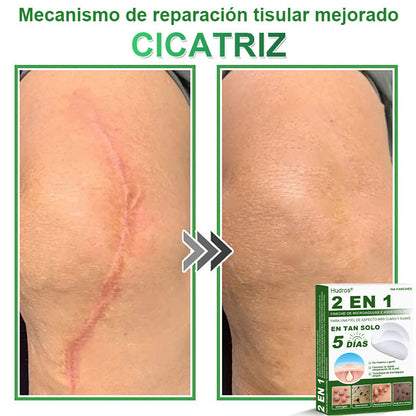𝐇𝐮𝐝𝐫𝐨𝐬® 📌𝐏𝐚𝐫𝐜𝐡𝐞𝐬 𝐡𝐢𝐝𝐫𝐨𝐜𝐨𝐥𝐨𝐢𝐝𝐞𝐬 𝐜𝐨𝐧 𝐦𝐢𝐜𝐫𝐨𝐚𝐠𝐮𝐣𝐚𝐬 𝟐 𝐞𝐧 𝟏🛒 𝐄𝐬𝐩𝐞𝐜𝐢𝐚𝐥𝐦𝐞𝐧𝐭𝐞 𝐝𝐢𝐬𝐞ñ𝐚𝐝𝐨𝐬 𝐩𝐚𝐫𝐚 𝐞𝐥𝐢𝐦𝐢𝐧𝐚𝐫 𝐥𝐮𝐧𝐚𝐫𝐞𝐬 𝐞𝐥𝐞𝐯𝐚𝐝𝐨𝐬, 𝐚𝐜𝐧é, 𝐯𝐞𝐫𝐫𝐮𝐠𝐚𝐬 𝐩𝐥𝐚𝐧𝐚𝐬 𝐲 𝐩𝐫𝐨𝐭𝐮𝐛𝐞𝐫𝐚𝐧𝐜𝐢𝐚𝐬 𝐜𝐮𝐭á𝐧𝐞𝐚𝐬 | 𝐏𝐚𝐪𝐮𝐞𝐭𝐞 𝐝𝐞 𝟏𝟒𝟒 𝐮𝐧𝐢𝐝𝐚𝐝𝐞𝐬🌳🌳