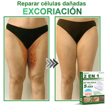 𝐇𝐮𝐝𝐫𝐨𝐬® 📌𝐏𝐚𝐫𝐜𝐡𝐞𝐬 𝐡𝐢𝐝𝐫𝐨𝐜𝐨𝐥𝐨𝐢𝐝𝐞𝐬 𝐜𝐨𝐧 𝐦𝐢𝐜𝐫𝐨𝐚𝐠𝐮𝐣𝐚𝐬 𝟐 𝐞𝐧 𝟏🛒 𝐄𝐬𝐩𝐞𝐜𝐢𝐚𝐥𝐦𝐞𝐧𝐭𝐞 𝐝𝐢𝐬𝐞ñ𝐚𝐝𝐨𝐬 𝐩𝐚𝐫𝐚 𝐞𝐥𝐢𝐦𝐢𝐧𝐚𝐫 𝐥𝐮𝐧𝐚𝐫𝐞𝐬 𝐞𝐥𝐞𝐯𝐚𝐝𝐨𝐬, 𝐚𝐜𝐧é, 𝐯𝐞𝐫𝐫𝐮𝐠𝐚𝐬 𝐩𝐥𝐚𝐧𝐚𝐬 𝐲 𝐩𝐫𝐨𝐭𝐮𝐛𝐞𝐫𝐚𝐧𝐜𝐢𝐚𝐬 𝐜𝐮𝐭á𝐧𝐞𝐚𝐬 | 𝐏𝐚𝐪𝐮𝐞𝐭𝐞 𝐝𝐞 𝟏𝟒𝟒 𝐮𝐧𝐢𝐝𝐚𝐝𝐞𝐬🌳🌳